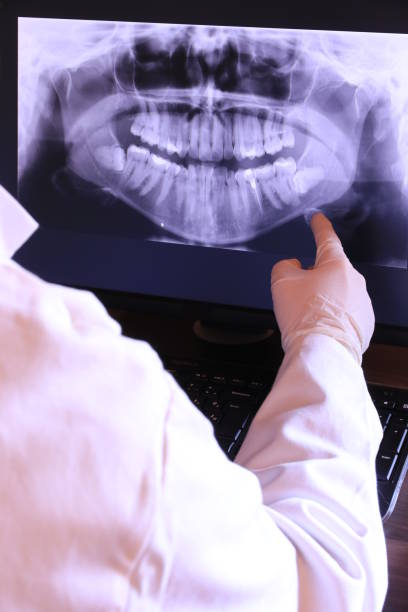 Best Broken or Cracked Tooth Emergency Dentist in Sandy, UT